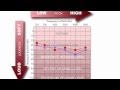 Hearing Loss and Audiograms