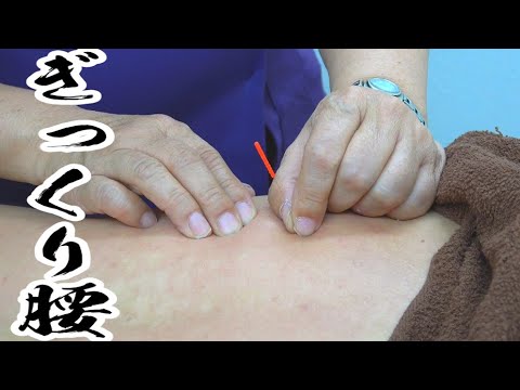 針を刺したらぎっくり腰が一瞬で治った！！