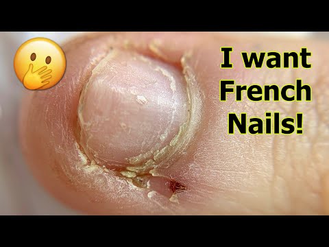 Short & bitten Nails Transformation to French Manicure