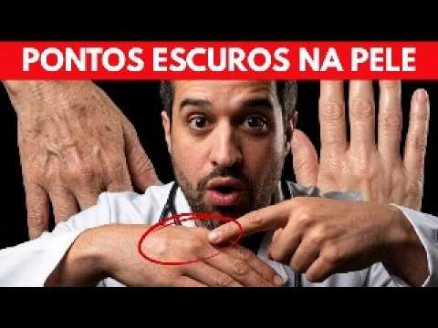 A Transformação Definitiva das Mãos – Melhor Remédio do MUNDO para RESSECAMENTO e RUGAS - Dr Renato