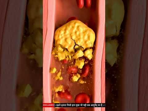 Ayurvedic Remedy for High Cholesterol | How to Reduce Cholesterol Naturally | Kadha For Heart Health