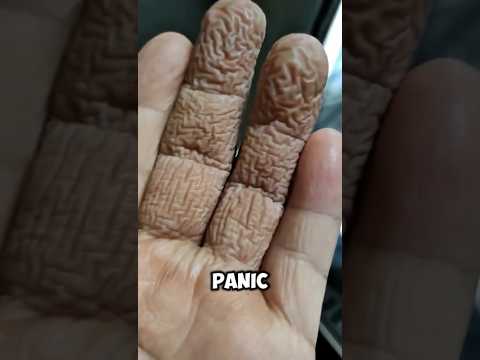If Your Fingers Start Looking Like This… Don’t Ignore It‼️😨