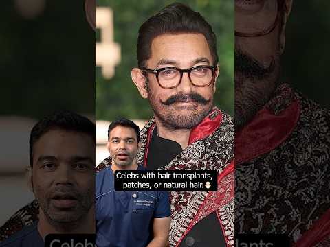 Did these celebs get hair patches or hair transplants?