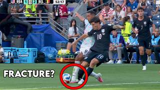 Christian Pulisic Broke His Leg vs Belgium (Kind of) - Doctor Explains