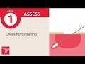 Wound Care Management Concepts