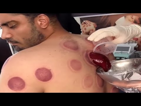 Tente Não Desviar o Olhar!!! #3