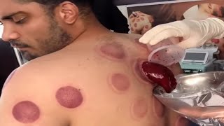Tente Não Desviar o Olhar!!! #3