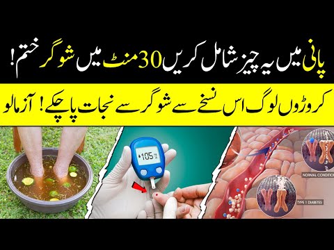 How To Control Sugar | Sugar Jar Sy Khatam Hojaye Gi | Sugar Ka Ilaaj | Islamic Teacher