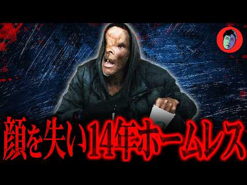 銃撃で顔半分を失った男…失業・家族と絶縁の先には…