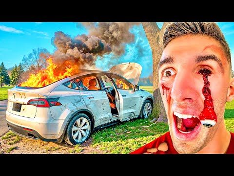 I Lost my EYEBALL in a Car Crash