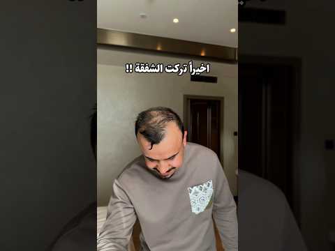 واخيرا قررت ازرع شعر #انكيدو