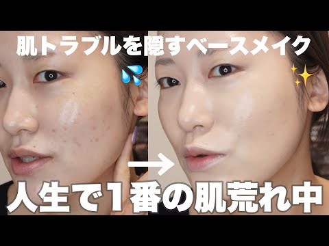 【GRWM】喋り過ぎてる肌荒れ爆発中の奥二重メイク【奥二重】