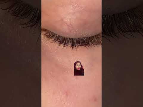 Qual a cor do seu olho?