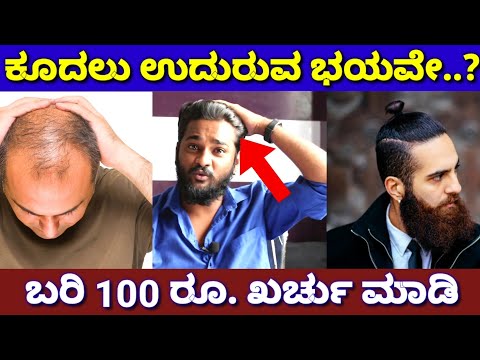 ಕೂದಲಿಗಾಗಿ ಲಕ್ಷ ಲಕ್ಷ ಖರ್ಚು ಮಾಡಿದವರು ಇಲ್ಲಿ ನೋಡಿ..! | How To Control Hair Fall | Hair Loss Tips