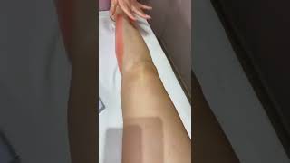 So satisfying leg waxing video || credits goes to salosalillari on TikTok