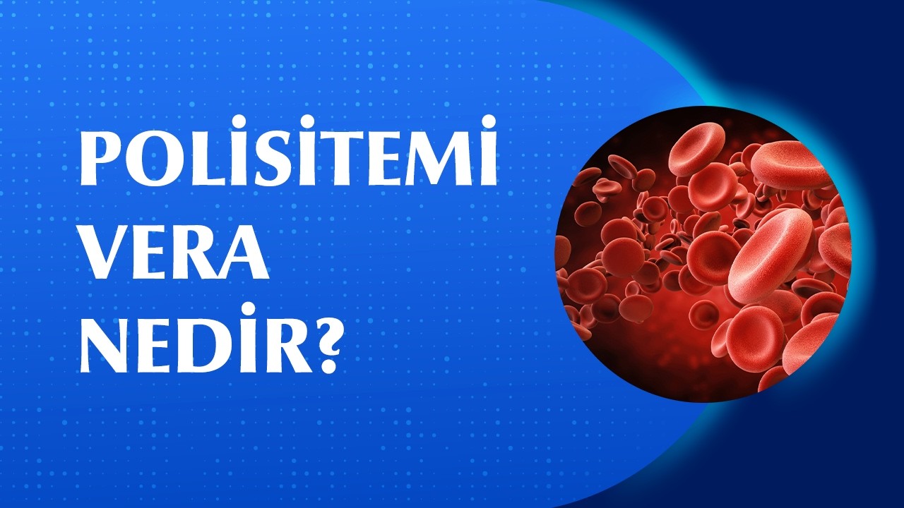 Kanınız Fazla Yoğunlaşıyorsa Bu Belirtilere Dikkat! Polisitemi Vera Nedir? Belirtileri Nelerdir?