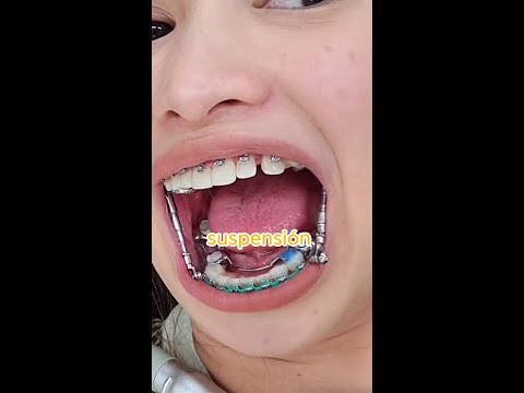 APARATO de dientes MUY EXTRAÑO 😮 #curiosidadN202 #las1000curiosidades #datoscuriosos