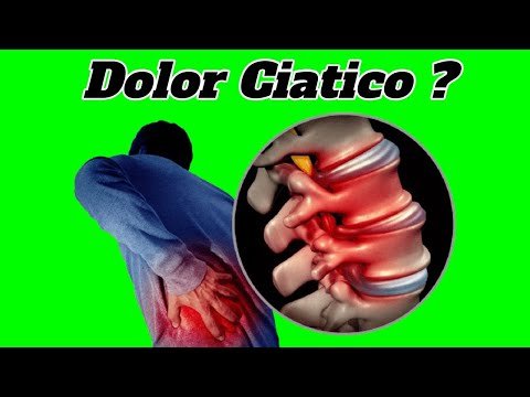 CIATICA TRATAMIENTO para el DOLOR de Nervio Quitar Dolor con Remedios Caseros 2024