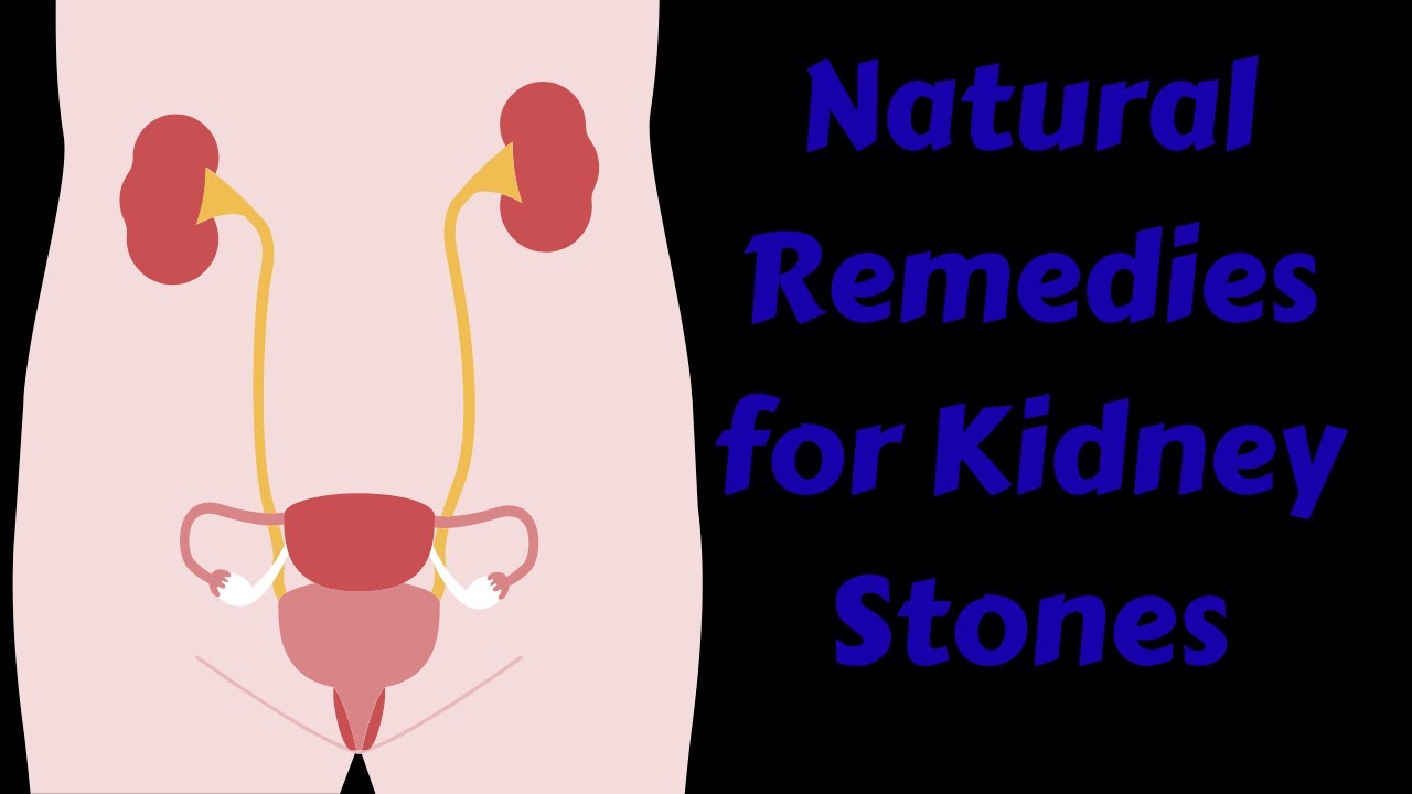 Effective Natural Remedies for Kidney Stones : Natural Remedies￼