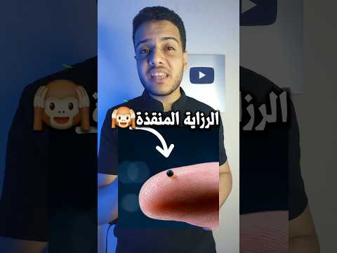ميكروروبوت يقدر ينقذ حياتك‼️😨#shorts