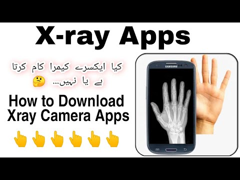 Is There An X Ray App That Really Works Jobs Ecityworks