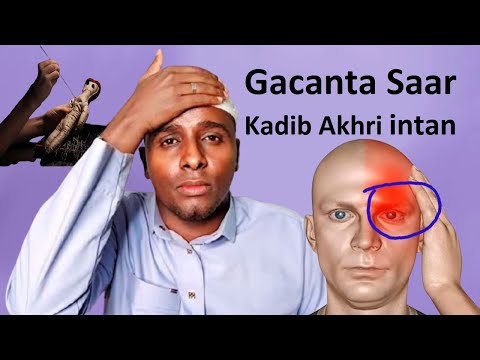 Gacanta Halkan saar kadib ku Akhri intaan jirkaada wuu isbadalin Adoo Arkaya nolol fereesh Helaysa