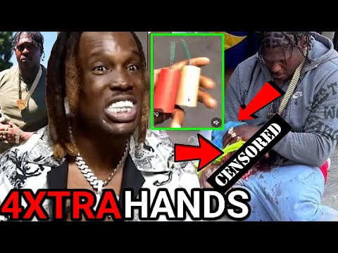 607 UNC Just Got 4xtra Hands Blown Off On 4TH of July After Attacking Him On NO Jumper Show? 🧨👋🏽👀