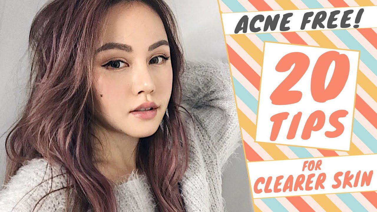 How to GET RID of ACNE 20 TIPS to Get CLEAR SKIN