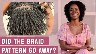 1 Year Mini Braid Microlocs | 12 Month Update • Natural Hair