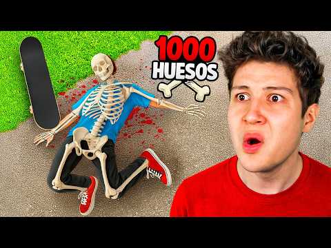 Me ROMPO 1000 HUESOS como un PATINADOR PROFESIONAL! 🛹🦴 (Skate)
