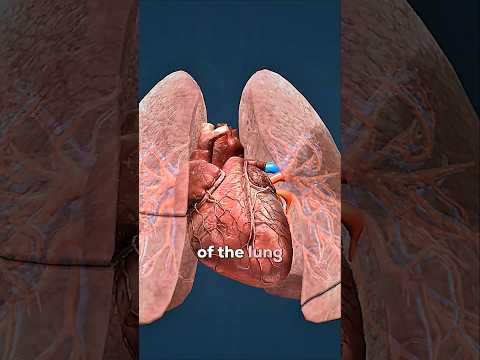 How a Blood Clot Makes it to the Lungs