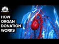 Organ Transplant Knowledge Assessment