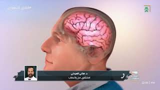 الغذاء والدواء  تسجل مستحضر لكمبي الذي يُعد أول علاج لمرض الزهايمر في المملكة