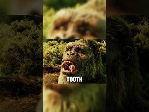 The human dentist replaced a metal denture for King Kong ๐ฆ๐ฆท