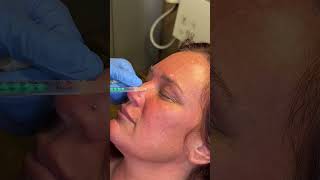 What A DAXXIFY Appointment Looks Like #injection #medspa #viral