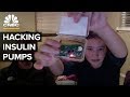 DIY Artificial Pancreas Systems Overview