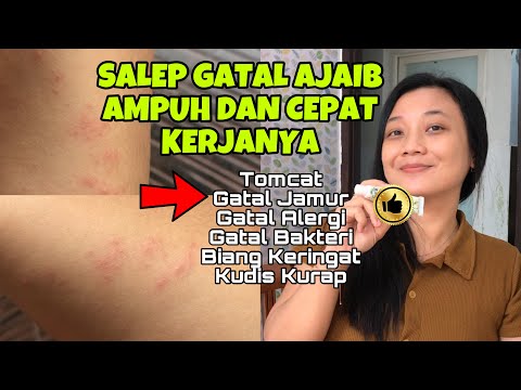 SALEP GATAL TERAMPUH DAN TERCEPAT! SEMRIWING REDAKAN RASA GATAL DAN CEPAT SEMBUH!