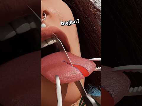 Rahasia Prosedur Lidah Bercabang