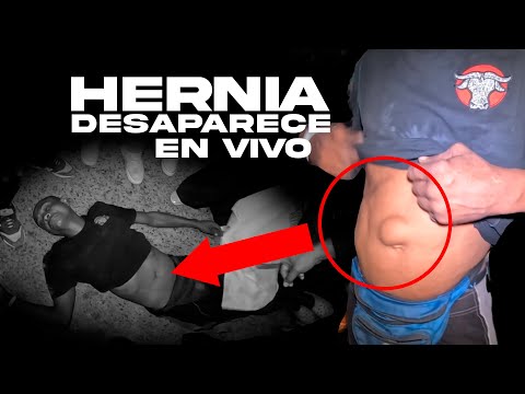 Este hombre fue operado por Dios frente a las cámaras ¡Milagro Creativo!