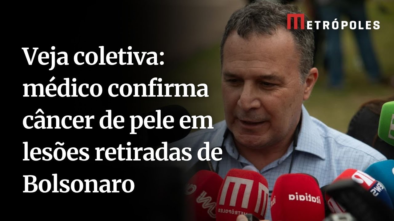 Veja coletiva médico confirma câncer de pele em lesões retiradas de Bolsonaro