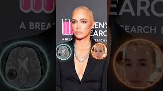 What is the real reason behind Teddi Mellencamp' s cancer?#shorts #celebrity