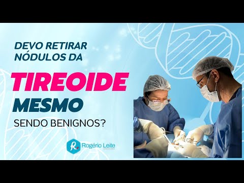 Devo retirar nódulos da tiroeide mesmo sendo benignos? - Dr. Rogério Leite