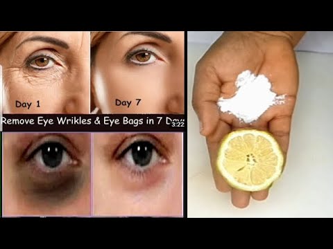 How to remove under eye wrinkles dark under eye and puffy eye