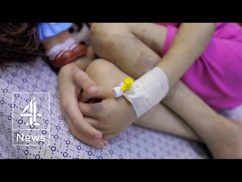 Neonatal unit struggles to treat malnourished children in Gaza City hospital