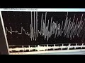 Understanding the Transcript