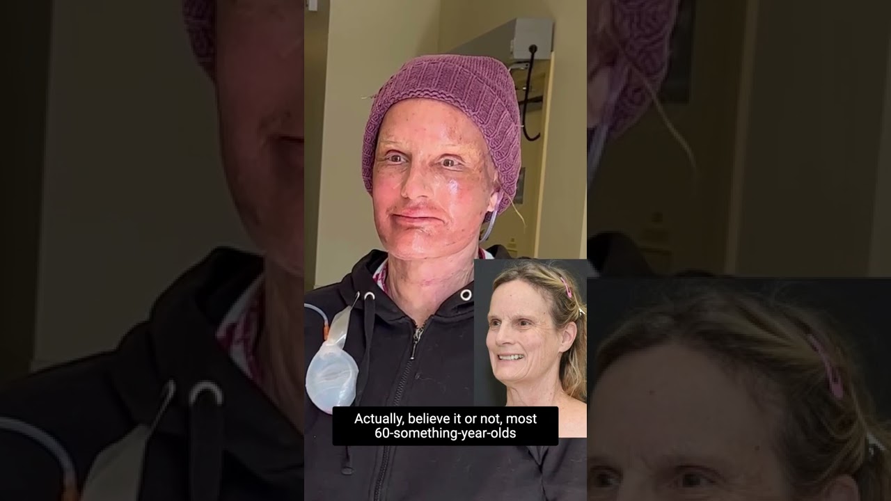 Person with facial treatment showcasing skin changes.