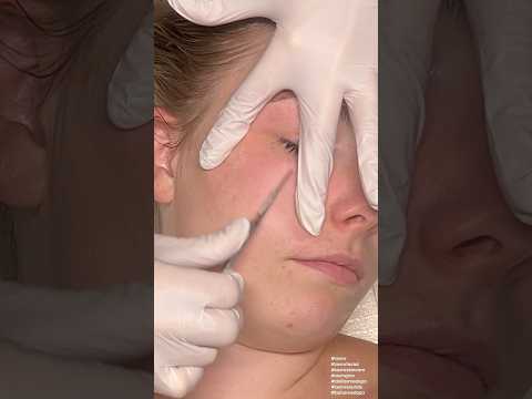 ZZZ ASMR Dermaplaning