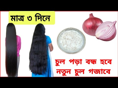 ৩ দিন এটা লাগাও চুল পড়া বন্ধ হবে নতুন চুল গজাবে /চুল লম্বা করার সহজ উপায় / চুলের যত্ন