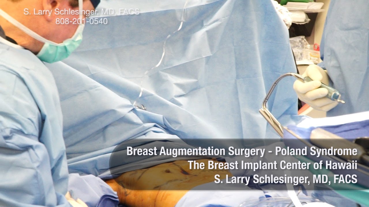 Breast Augmentation Surgery (GRAPHIC) for Patient with Minimal Pectoralis Muscle - Breast Implant Center of Hawaii