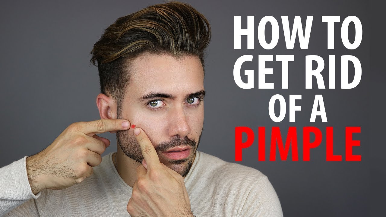 How To Get Rid of a Pimple Overnight - Fast Pimple and Acne Treatments - Alex Costa